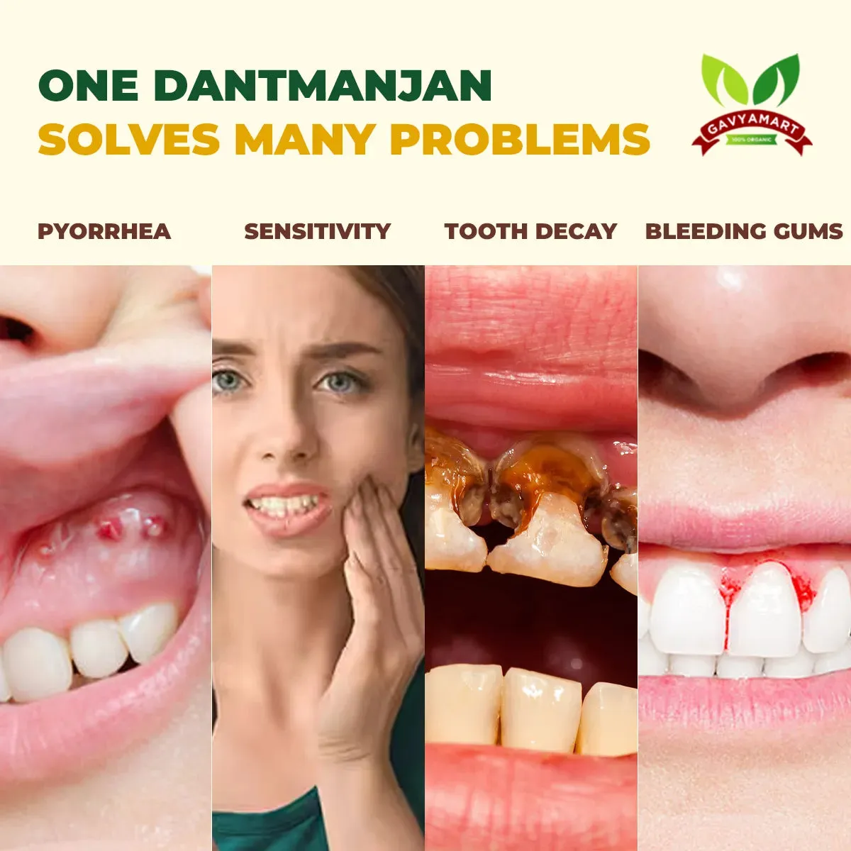 Gomay Dant Manjan (Herbal Tooth Powder) – photo 5